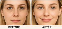 Home Eye Care Device for Wrinkles and Dark Circles
