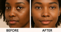 Home Eye Care Device for Wrinkles and Dark Circles