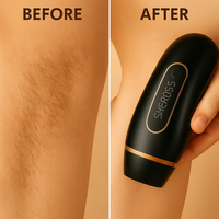 Home Laser Hair Removal Device for Full Body Care